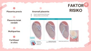 Plasenta previa
Fertilisasi
in vitro
Plasenta letak
rendah
Anomali plasenta
Multiparitas
● Insersi velamentosa tali pusar
● Adanya lobus succenturiate
FAKTOR
RISIKO
 