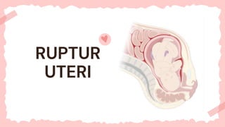 RUPTUR
UTERI
 