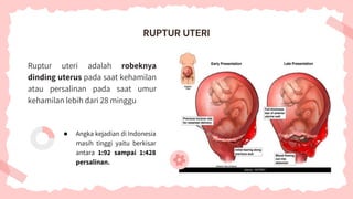 Ruptur uteri adalah robeknya
dinding uterus pada saat kehamilan
atau persalinan pada saat umur
kehamilan lebih dari 28 minggu
● Angka kejadian di Indonesia
masih tinggi yaitu berkisar
antara 1:92 sampai 1:428
persalinan.
RUPTUR UTERI
 