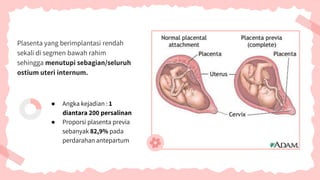 Plasenta yang berimplantasi rendah
sekali di segmen bawah rahim
sehingga menutupi sebagian/seluruh
ostium uteri internum.
● Angka kejadian : 1
diantara 200 persalinan
● Proporsi plasenta previa
sebanyak 82,9% pada
perdarahan antepartum
 