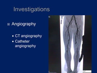  Contrast directly into artery
 Traumatic
 DSA – Digital subtraction angiography
 Done though a software after obtaini...