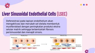 Liver Sinusoidal Endothelial Cells (LSEC)
Defenestrasi pada lapisan endothelium akan
mengaktivasi dan merubah sel stelata membentuk
myofibroblast dengan peningkatan produksi ekstra
selular matrik sehingga terbentuklah fibrosis
perisinusoidal dan menajdi sirosis.
 