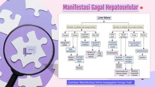Manifestasi Gagal Hepatoselular
Gambar Manifestasi klinis kegagalan fungsi hati
 