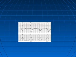 Cst Algorithm Australia Cst | PPT