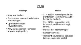 CMB
Histology
• Very few studies.
• Perivascular haemosiderin laden
macrophages.
• Lipofibrohyalinosis
(Hypertension).
• Amyloid deposition (Cerebral
amyloid angiopathy).
Clinical
• 11 – 15% in normal population
(Rotterdam scan study & AGES –
Reykjavik studies).
• 33 – 67% in population with
Ischameic and haemorrhagic
stroke.
• Intracranial haemorrhages
• Ischaemic events
• Transient neurological episodes
(seizures/Amyloid spells)
 