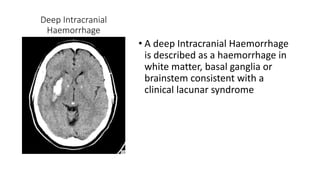 Deep Intracranial
Haemorrhage
• A deep Intracranial Haemorrhage
is described as a haemorrhage in
white matter, basal ganglia or
brainstem consistent with a
clinical lacunar syndrome
 