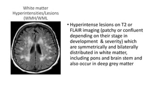 White matter
Hyperintensities/Lesions
(WMH/WML
• Hyperintense lesions on T2 or
FLAIR imaging (patchy or confluent
depending on their stage in
development & severity) which
are symmetrically and bilaterally
distributed in white matter,
including pons and brain stem and
also occur in deep grey matter
 
