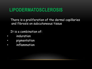 LIPODERMATOSCLEROSIS
There is a proliferation of the dermal capillaries
and fibrosis on subcutaneous tissue
It is a combination of:
• induration
• pigmentation
• inflammation
 