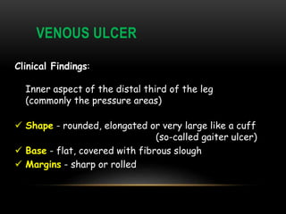 VENOUS ULCER
Clinical Findings:
Inner aspect of the distal third of the leg
(commonly the pressure areas)
 Shape - rounded, elongated or very large like a cuff
(so-called gaiter ulcer)
 Base - flat, covered with fibrous slough
 Margins - sharp or rolled
 