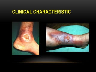 CLINICAL CHARACTERISTIC
 