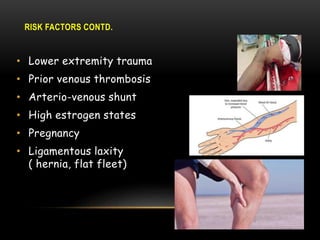 RISK FACTORS CONTD.
• Lower extremity trauma
• Prior venous thrombosis
• Arterio-venous shunt
• High estrogen states
• Pregnancy
• Ligamentous laxity
( hernia, flat fleet)
 