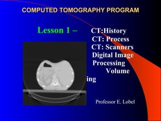 COMPUTED TOMOGRAPHY PROGRAM Professor E. Lobel Lesson 1 –     CT:History   CT: Process CT: Scanners Digital Image    Processing   Volume Scanning 