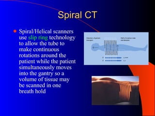 Spiral CT Spiral/Helical scanners use  slip ring  technology to allow the tube to make continuous rotations around the patient while the patient simultaneously moves into the gantry so a volume of tissue may be scanned in one breath hold                                                                                  