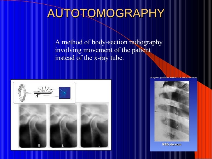 Image Result For Computerized X Ray Imaging In The Transverse Plane Image Result For Computerized X Ray Imaging In The Transverse Plane
