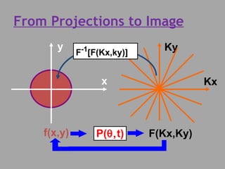 From Projections to Image y x Ky Kx F -1 [F(Kx,ky)] f(x,y) P(  t) F(Kx,Ky)  