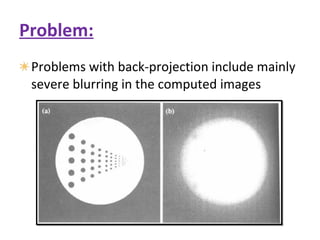 Problem: Problems with back-projection include mainly severe blurring in the computed images 