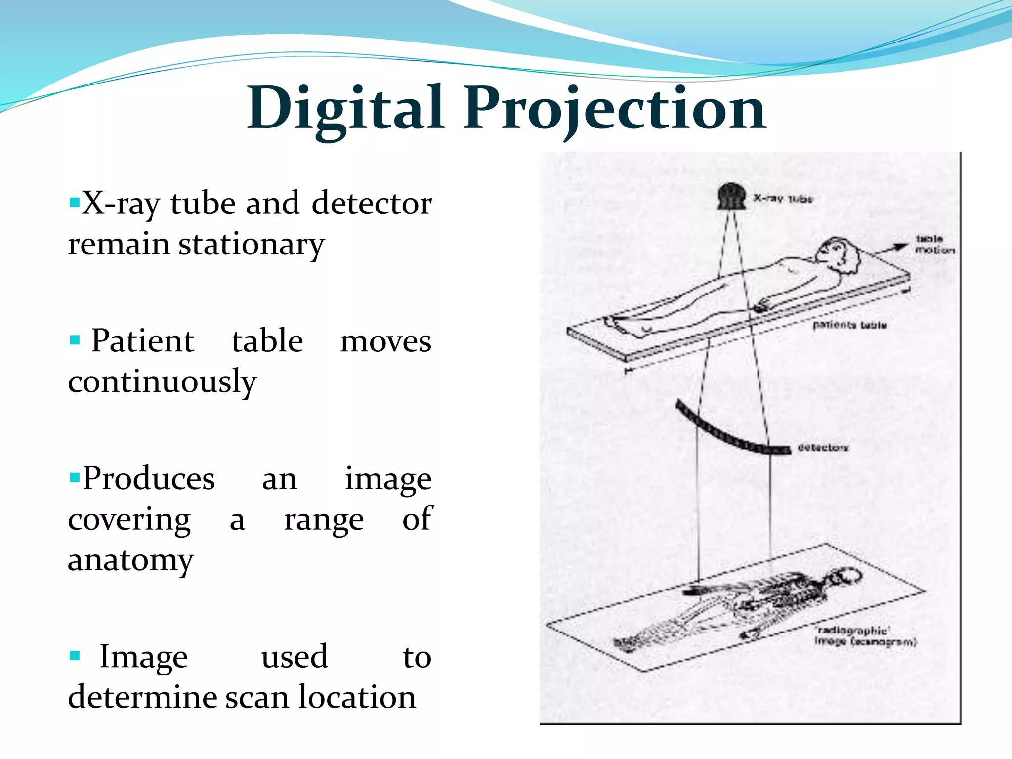 Digital Projection 
X-ray tube and detector 
remain stationary 
 Patient table moves 
continuously 
Produces an image 
covering a range of 
anatomy 
 Image used to 
determine scan location 
 