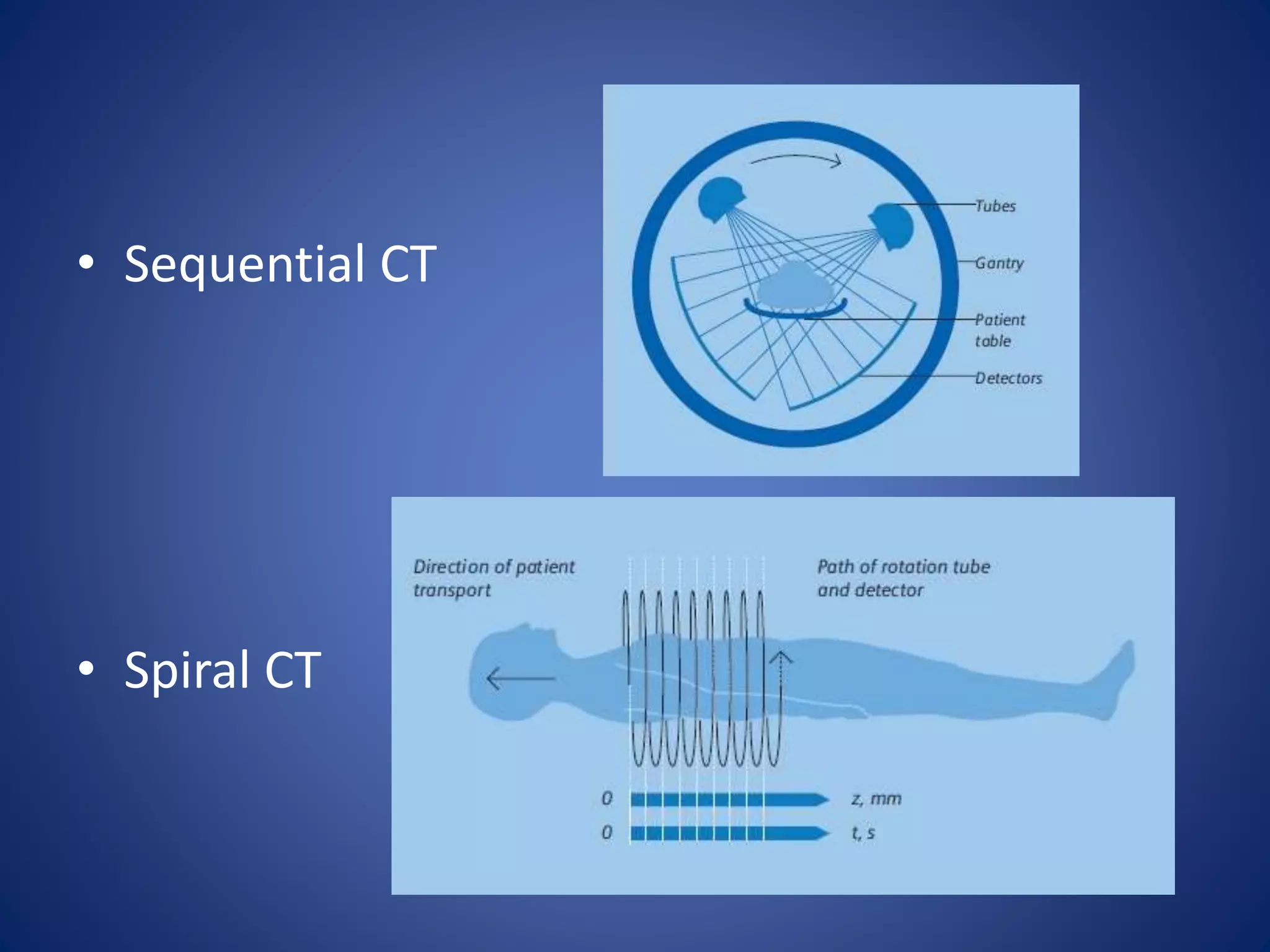 • Sequential CT
• Spiral CT
 