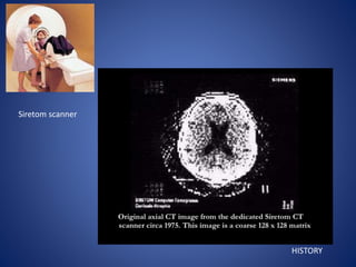 HISTORY
Siretom scanner
 
