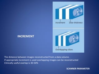 INCREMENT
SCANNER PARAMETER
The distance between images reconstructed from a data volume .
If appropriate increment is used overlapping images can be reconstructed
Clinically useful overlap is 30-50%
 