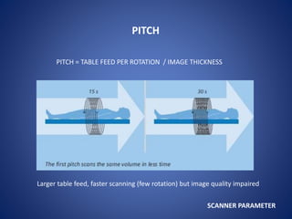PITCH
PITCH = TABLE FEED PER ROTATION / IMAGE THICKNESS
SCANNER PARAMETER
Larger table feed, faster scanning (few rotation) but image quality impaired
 
