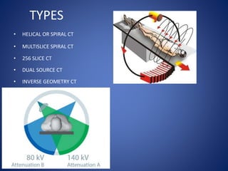 TYPES
• HELICAL OR SPIRAL CT
• MULTISLICE SPIRAL CT
• 256 SLICE CT
• DUAL SOURCE CT
• INVERSE GEOMETRY CT
 