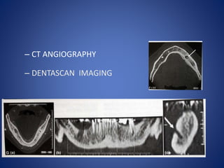 – CT ANGIOGRAPHY
– DENTASCAN IMAGING
 