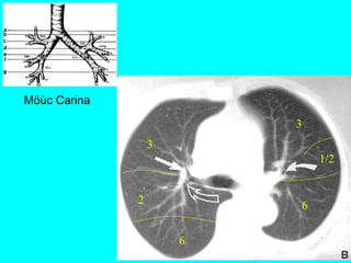 Möùc Carina
3
3
6
2
6
1/2
 