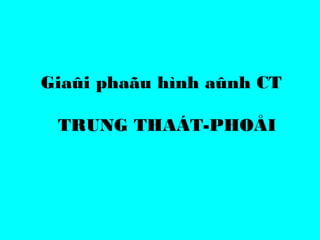 Giaûi phaãu hình aûnh CT
TRUNG THAÁT-PHOÅI
 