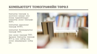 КОМПЬЮТЕРТ ТОМОГРАФИЙН ТӨРӨЛ
Компьютер томограф нь
зүсэлтээсээ хамаарч олон
янзаар тодорхойлогддог:
компьютер аксиал томографи
(KAT),
компьютерт трансаксиал
томограф (KTAT),
компьютерт боловсруулалтын
томограф (КБТ),
тоон аксиал томограф (TAT).
Эдгээрээс Компьютер томограф
(KT) нь олон нийтэд илүү
хүлээн зөвшөөрөгдсөн хэлбэр
юм.
 