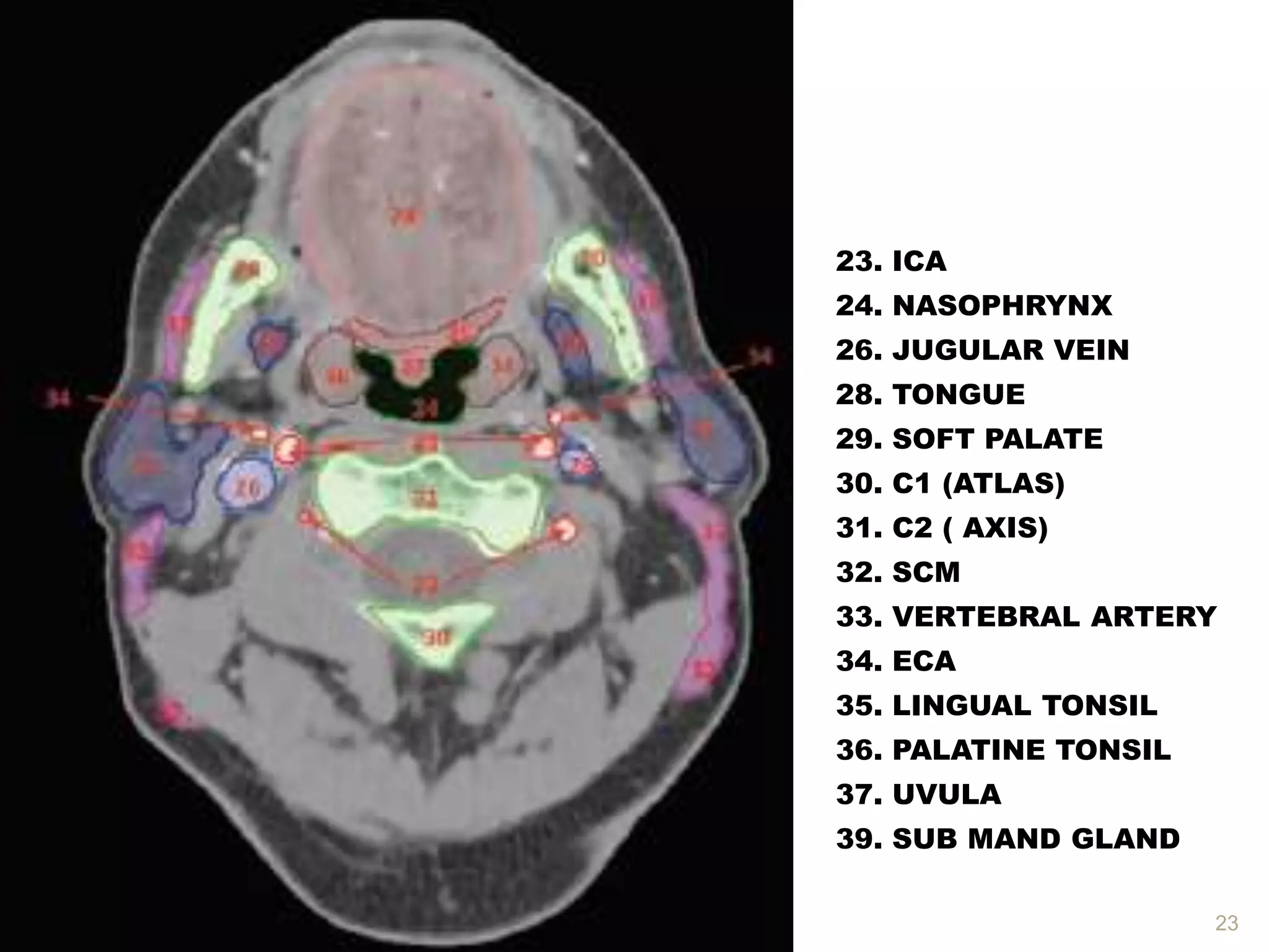 Ct ANATOMY HEAD AND NECK | PPTX