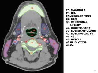 28
20. MANDIBLE
23. ICA
26 JUGULAR VEIN
32. SCM
33. VERTEBRAL
ARTERY
38. OROPHARYNX
39. SUB MAND GLAND
40. SUBLINGUAL SG
41. C3
42. HYPO P
43 EPIGLOTTIS
44 C4
 