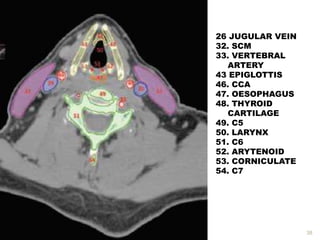38
26 JUGULAR VEIN
32. SCM
33. VERTEBRAL
ARTERY
43 EPIGLOTTIS
46. CCA
47. OESOPHAGUS
48. THYROID
CARTILAGE
49. C5
50. LARYNX
51. C6
52. ARYTENOID
53. CORNICULATE
54. C7
 