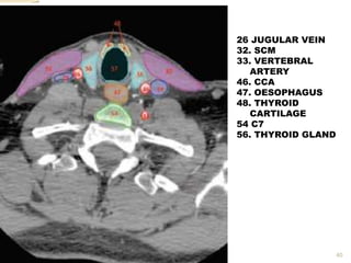40
26 JUGULAR VEIN
32. SCM
33. VERTEBRAL
ARTERY
46. CCA
47. OESOPHAGUS
48. THYROID
CARTILAGE
54 C7
56. THYROID GLAND
 