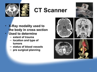 CT Scanner
• X-Ray modality used to
the body in cross section
• Used to determine
– extent of trauma
– location and type of
tumors
– status of blood vessels
– pre surgical planning
10
 