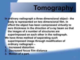 Tomography
In ordinary radiograph a three dimensional object - the
body is represented on two dimensional film. In
effect the object has been compressed virtually to
zero thickness in the direction of x-ray beam so that
the images of a number of structures are
superimposed on each other in the radiograph.
We have three method of separating such
superimposed image through modification of
ordinary radiograph –
1. Increased distortion
2. Decreased focus film distance
3. Motion of a part.
112
 