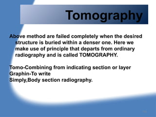 Tomography
Above method are failed completely when the desired
structure is buried within a denser one. Here we
make use of principle that departs from ordinary
radiography and is called TOMOGRAPHY.
Tomo-Combining from indicating section or layer
Graphin-To write
Simply,Body section radiography.
113
 