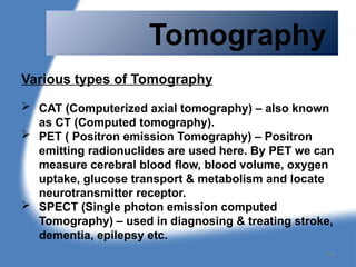 Tomography
Various types of Tomography
 CAT (Computerized axial tomography) – also known
as CT (Computed tomography).
 PET ( Positron emission Tomography) – Positron
emitting radionuclides are used here. By PET we can
measure cerebral blood flow, blood volume, oxygen
uptake, glucose transport & metabolism and locate
neurotransmitter receptor.
 SPECT (Single photon emission computed
Tomography) – used in diagnosing & treating stroke,
dementia, epilepsy etc.
114
 
