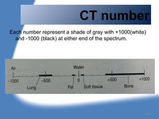CT number
Each number represent a shade of gray with +1000(white)
and -1000 (black) at either end of the spectrum.
140
 