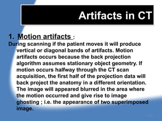 Artifacts in CT
1. Motion artifacts :
During scanning if the patient moves it will produce
vertical or diagonal bands of artifacts. Motion
artifacts occurs because the back projection
algorithm assumes stationary object geometry. If
motion occurs halfway through the CT scan
acquisition, the first half of the projection data will
back project the anatomy in a different orientation.
The image will appeared blurred in the area where
the motion occurred and give rise to image
ghosting ; i.e. the appearance of two superimposed
image.
150
 