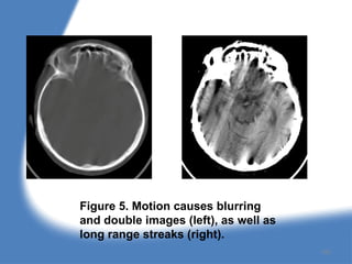 Figure 5. Motion causes blurring
and double images (left), as well as
long range streaks (right).
152
 