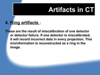 Artifacts in CT
4. Ring artifacts :
These are the result of miscalibration of one detector
or detector failure. If one detector is miscalibrated,
it will record incorrect data in every projection. This
misinformation is reconstructed as a ring in the
image.
157
 