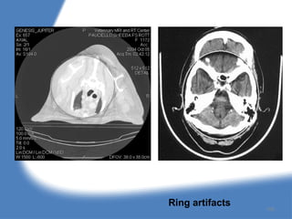 Ring artifacts
158
 