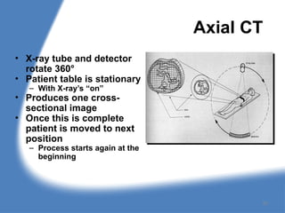 Axial CT
• X-ray tube and detector
rotate 360°
• Patient table is stationary
– With X-ray’s “on”
• Produces one cross-
sectional image
• Once this is complete
patient is moved to next
position
– Process starts again at the
beginning
20
 