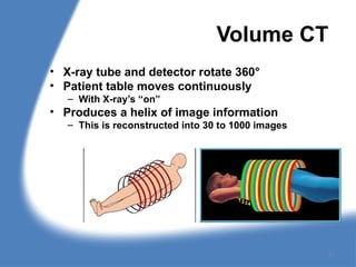Volume CT
• X-ray tube and detector rotate 360°
• Patient table moves continuously
– With X-ray’s “on”
• Produces a helix of image information
– This is reconstructed into 30 to 1000 images
21
 