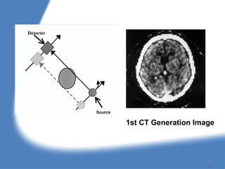 1st CT Generation Image
28
 