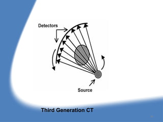 Third Generation CT
34
 