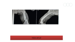 Case study of wrist AP and Lateral. Case study of Thigh AP and Lateral ...