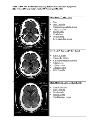 Ct brain | PDF