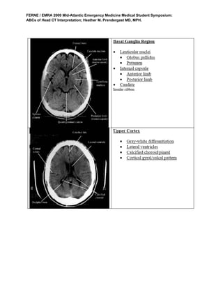 Ct brain | PDF